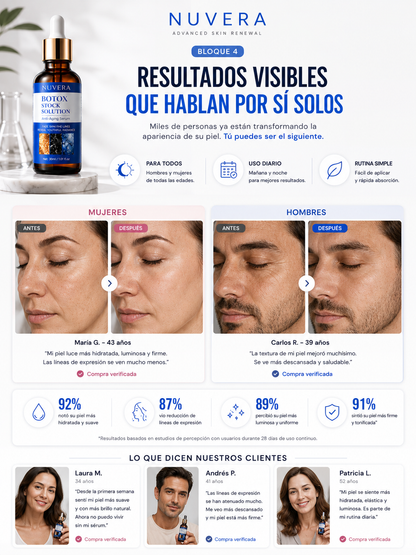 Botox en Gotas!
